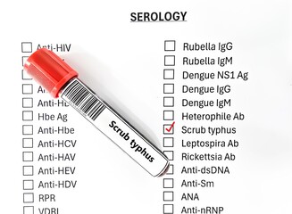 Blood sample tube and paper order request for scrub typhus test analysis.