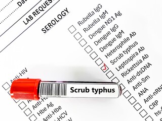 Blood sample tube and paper order request for scrub typhus test analysis.