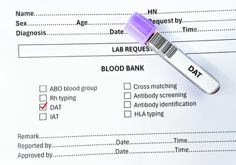 Blood sample tube and paper order request for direct antiglobulin test analysis.