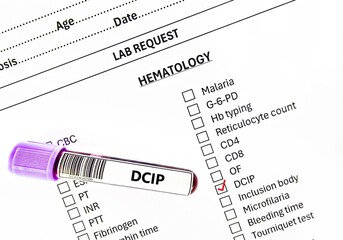 Blood sample tube and paper order request for DCIP test analysis.