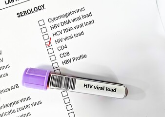 Blood sample tube and paper order request for HIV viral load test analysis.