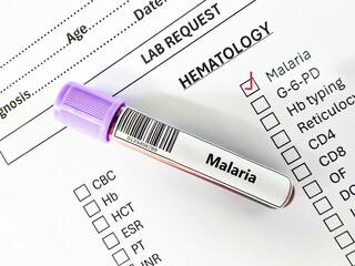 Blood sample tube and paper order request for malaria test analysis.