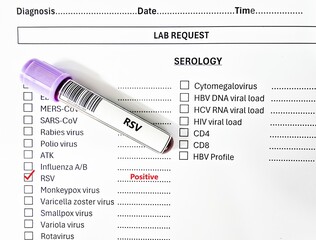Blood sample tube positive result for RSV virus test analysis.