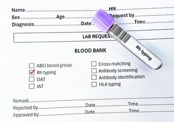 Blood sample tube and paper order request for Rh typing test analysis.