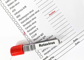 Blood sample tube positive result for rotavirus.