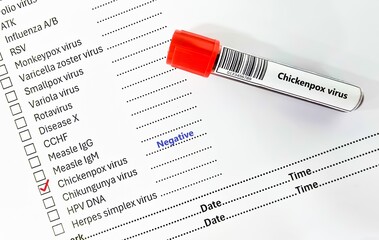 Blood sample tube negative result for chikungunya virus.