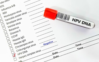 Blood sample tube negative result for HPV DNA.