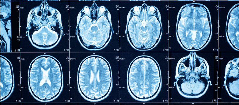 Closeup of a CT scan with brain. Medical, science and education mri brain background. Magnetic resonance imaging.