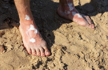 Men's feet with sunscreen spray applied