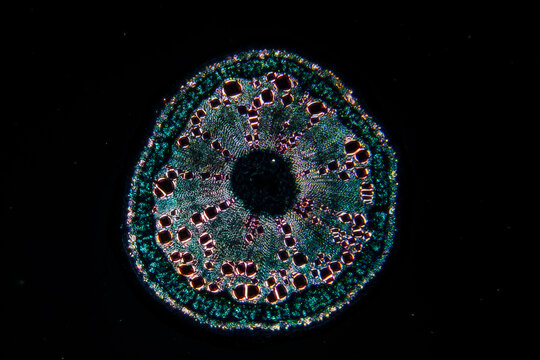 micrograph of Herba Abrus plant cells
