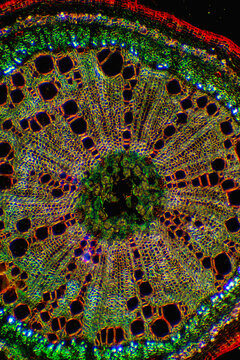 micrograph of Herba Abrus plant cells