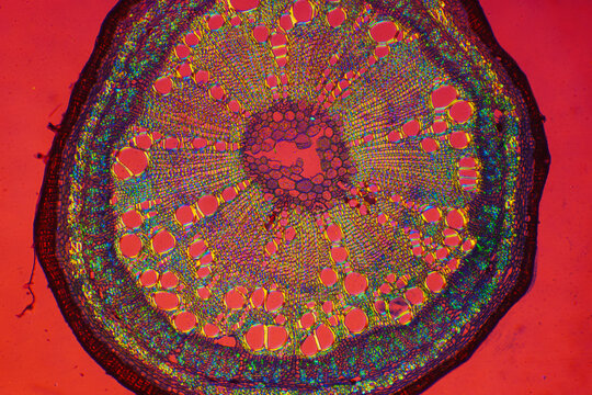 micrograph of Herba Abrus plant cells