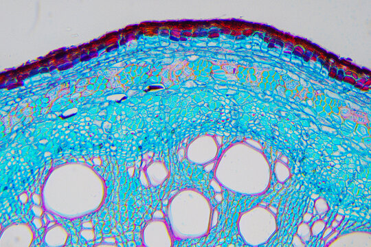 micrograph of Herba Abrus plant cells