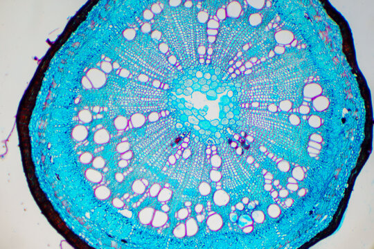 micrograph of Herba Abrus plant cells