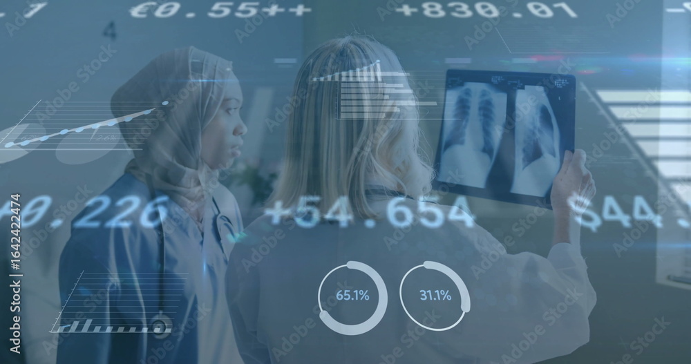Aufkleber reviewing team in lab coat and scrubs analyzing x-ray on lightbox in radiology with data overlays