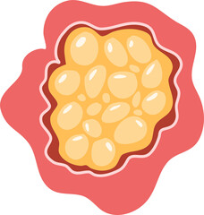 Cancerous tumor, cancer cell growth. cancer disease concept