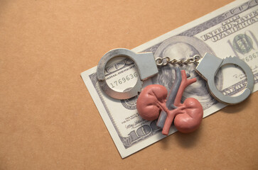 Kidney Trafficking Concept with Model Organ on One Hundred Dollar Bill Highlighting Crime and...