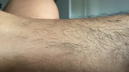 Close-up of a hairy human arm, showing the skin texture and hair follicles.