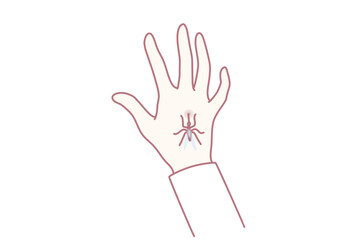 Close up of mosquito bite hand. Bug or insect biting person leave spot or mark. Healthcare and nature. Vector illustration.