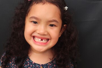 Asian girl with curly hair smiles adorable while showing her missing upper teeth, close-up view and...