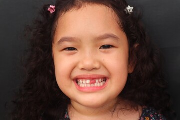 Asian girl with curly hair smiles adorable while showing her missing upper teeth, close-up view and...