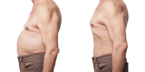 Before and after collage showing man with good and bad posture against white background, closeup