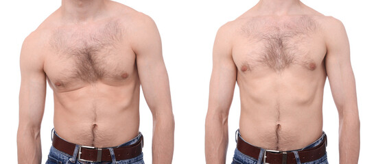 Before and after collage showing man with good and bad posture against white background, closeup