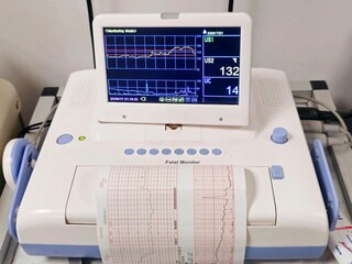 Cardiotocography device placed on mother's abdomen recording the fetal heart rate obtained via ultrasound transducer, CTG is used to assess fetal well-being by identifying babies at risk of hypoxia