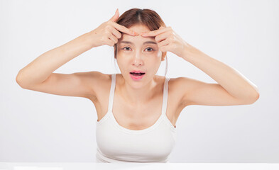 Acne on the forehead and acne near her cheek highlight a woman battle with skin blemishes, showing...