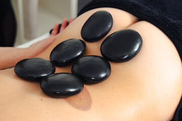 Close-up of a hot stone massage therapy session with smooth black basalt stones placed on a...