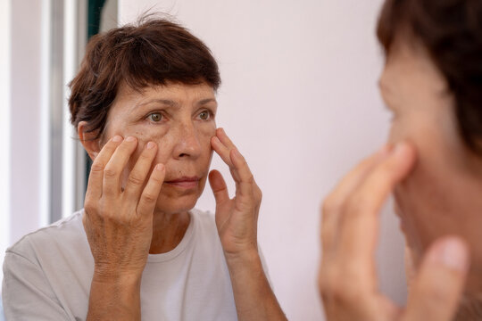 Mature woman examining puffiness and under-eye bags in the mirror. Natural signs of aging, skincare awareness, and self-care moment. Age-related skin changes, fatigue. Cosmetology and beauty concept