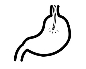 胃カメラ　イラスト