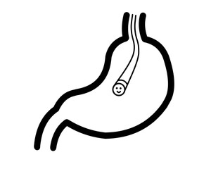 Obraz premium 胃カメラ イラスト