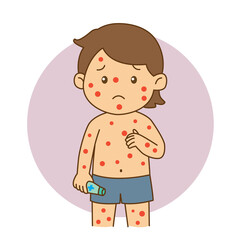 A boy has chickenpox and has red bumps all over his body, Illustration cartoon on white background