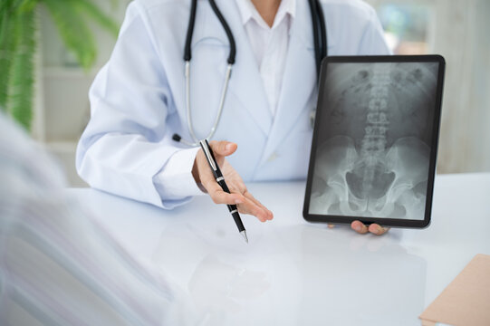 Orthopedist doctor explain spine lumber vertebrae x-ray image on digital tablet to the patient for diagnose Herniated Disc disease and Spondylosis, Spondylolisthesis.