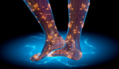 Restless Legs Syndrome RLS - Highlighted nerves showing Neuropathic foot and leg pain - 3D illustration 