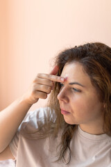 Close-up of a young woman applying a cream directly to a red, inflamed pimple on her face....