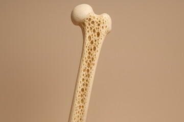 Human femur bone with porous structure, osteoporosis medical concept showing weakened skeletal tissue, anatomical model of bone cross section for healthcare education, orthopedics research, disease pr