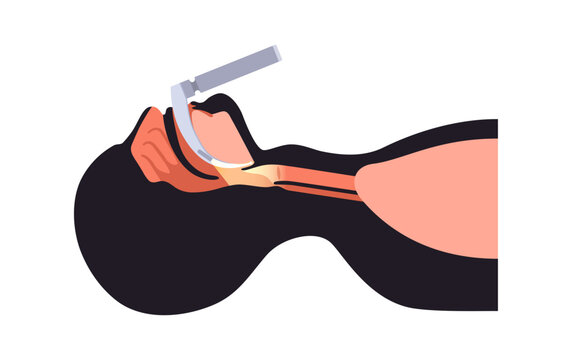 Laryngoscopy medical procedure