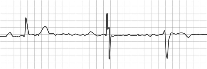 High-quality ECG trace showcases clear heartbeat pattern on grid, ideal for medical, health, and science-related projects, for educational or professional use