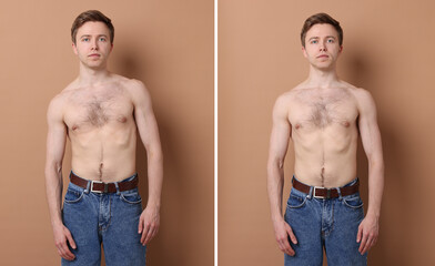 Before and after collage showing man with good and bad posture against pale brown background