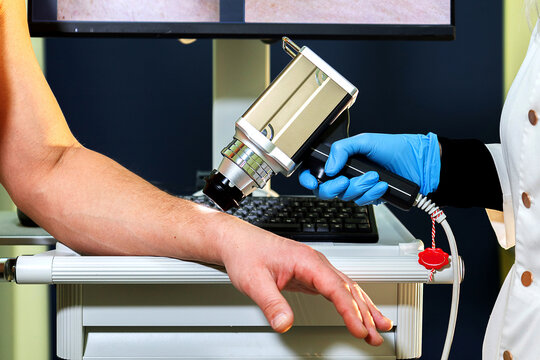 Digital dermatoscopy. Early diagnosis and prevention of skin cancer.