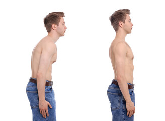 Before and after collage showing man with good and bad posture against white background