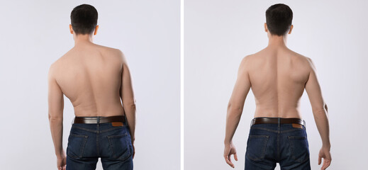 Before and after collage showing man with good and bad posture against white background