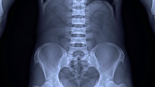 Xray of human spine and pelvis Medical healthcare diagnostic concept.
