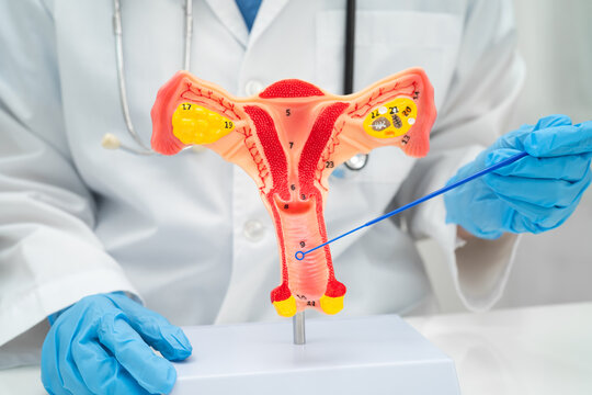 Doctor holding human uterus model for vaginal and cervix pap smear check up in the obstetrics and gynecology.