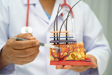 Hair transplant, Asian dermatologist doctor holding skin structure anatomy model for treatment in hospital.