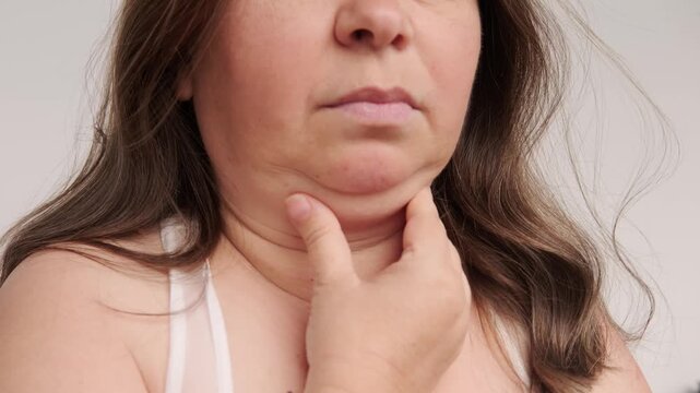 close up part female face, mature woman 50 years old, human fat neck, side view, double saggy chin, deep wrinkles, age-related skin changes, cosmetic anti-aging procedures, Health and Wellness
