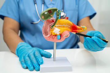 Pancreatitis, pancreatic cancer, Asian doctor with pancreas, gallbladder and bile duct human...