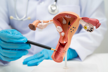 Uterus, doctor holding human anatomy model for study diagnosis and treatment in hospital.